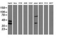 Anti-Haptoglobin antibody [2B11] used in Western Blot (WB). GTX84348