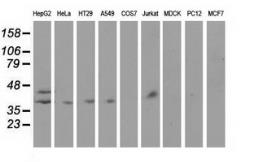 Anti-Haptoglobin antibody [4H5] used in Western Blot (WB). GTX84352