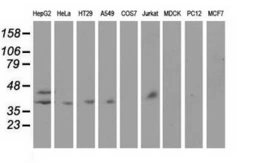 Anti-Haptoglobin antibody [4H5] used in Western Blot (WB). GTX84352