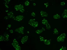 Anti-Hexokinase II antibody [4C5] used in Immunocytochemistry/ Immunofluorescence (ICC/IF). GTX84357