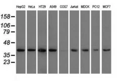 Anti-HIBCH antibody [1C7] used in Western Blot (WB). GTX84362
