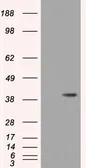 Anti-HIBCH antibody [3H5] used in Western Blot (WB). GTX84364