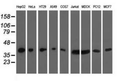 Anti-HIBCH antibody [4G1] used in Western Blot (WB). GTX84368