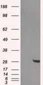 Anti-HDHD2 antibody [2C12] used in Western Blot (WB). GTX84376