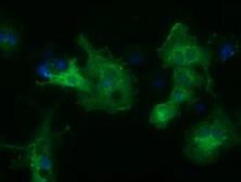 Anti-HDAC6 antibody [4C5] used in Immunocytochemistry/ Immunofluorescence (ICC/IF). GTX84377