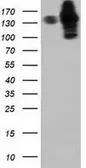 Anti-HDAC6 antibody [4C5] used in Western Blot (WB). GTX84377