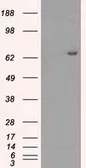 Anti-HDAC10 antibody [6D4] used in Western Blot (WB). GTX84382