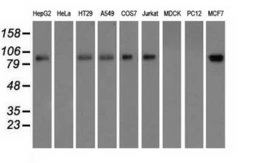 Anti-H6PD antibody [2A7] used in Western Blot (WB). GTX84395
