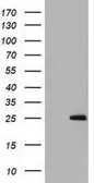Anti-GSTA4 antibody [1E2] used in Western Blot (WB). GTX84404