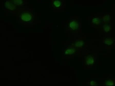 Anti-GSC antibody [4F11] used in Immunocytochemistry/ Immunofluorescence (ICC/IF). GTX84409
