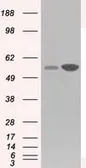 Anti-GPI antibody [5A11] used in Western Blot (WB). GTX84416