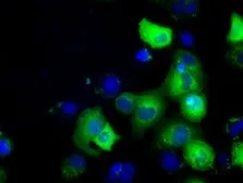 Anti-GRASP65 antibody [5C5] used in Immunocytochemistry/ Immunofluorescence (ICC/IF). GTX84423