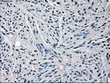 Anti-Glutamine synthetase antibody [1F4] used in IHC (Paraffin sections) (IHC-P). GTX84426