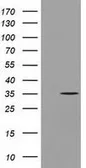 Anti-GGPS1 antibody [3F9] used in Western Blot (WB). GTX84427