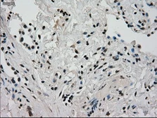 Anti-Glucokinase antibody [3E3] used in IHC (Paraffin sections) (IHC-P). GTX84440