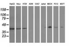 Anti-GAS7 antibody [2F6] used in Western Blot (WB). GTX84462