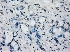 Anti-FRK antibody [6D2] used in IHC (Paraffin sections) (IHC-P). GTX84481
