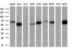 Anti-FRK antibody [7A7] used in Western Blot (WB). GTX84483