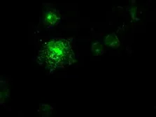 Anti-Flt3 Ligand antibody [8D10] used in Immunocytochemistry/ Immunofluorescence (ICC/IF). GTX84489
