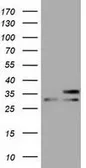 Anti-FHL1 antibody [3G7] used in Western Blot (WB). GTX84494