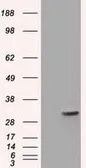 Anti-FHL1 antibody [1D6] used in Western Blot (WB). GTX84495