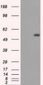 Anti-Fumarate hydratase antibody [2A2] used in Western Blot (WB). GTX84499