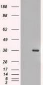 Anti-FGF2 antibody [2H11] used in Western Blot (WB). GTX84501