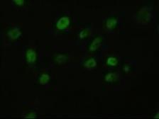 Anti-FGF2 antibody [3D9] used in Immunocytochemistry/ Immunofluorescence (ICC/IF). GTX84502