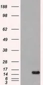 Anti-FGF1 antibody [4D2] used in Western Blot (WB). GTX84503