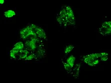 Anti-Mig-2 antibody [25A4] used in Immunocytochemistry/ Immunofluorescence (ICC/IF). GTX84505
