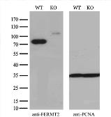Anti-Mig-2 antibody [14A11] used in Western Blot (WB). GTX84506