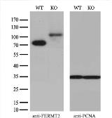 Anti-Mig-2 antibody [9E4] used in Western Blot (WB). GTX84507