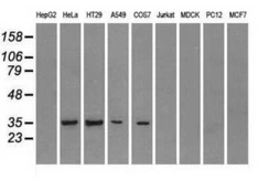 Anti-CD32a antibody [20D1] used in Western Blot (WB). GTX84508