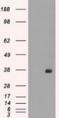 Anti-CD32a antibody [16D6] used in Western Blot (WB). GTX84509