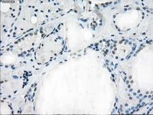 Anti-CD32a antibody [13D7] used in IHC (Paraffin sections) (IHC-P). GTX84511