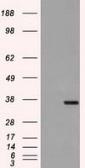 Anti-CD32a antibody [13D7] used in Western Blot (WB). GTX84511