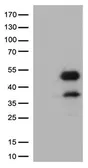 Anti-CD32a antibody [16E7] used in Western Blot (WB). GTX84518