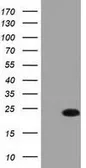Anti-FADD antibody [1C11] used in Western Blot (WB). GTX84542