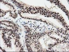 Anti-EPM2AIP1 antibody [1F11] used in IHC (Paraffin sections) (IHC-P). GTX84561