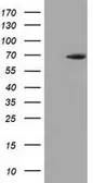 Anti-EPM2AIP1 antibody [2A5] used in Western Blot (WB). GTX84564