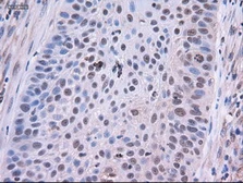 Anti-EpCAM antibody [2C8] used in IHC (Paraffin sections) (IHC-P). GTX84572