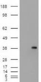 Anti-EpCAM antibody [2C8] used in Western Blot (WB). GTX84572