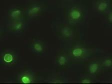 Anti-EpCAM antibody [2H9] used in Immunocytochemistry/ Immunofluorescence (ICC/IF). GTX84573