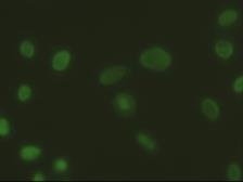 Anti-EpCAM antibody [2H9] used in Immunocytochemistry/ Immunofluorescence (ICC/IF). GTX84573