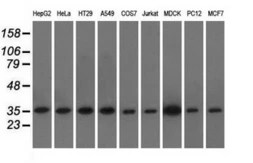Anti-eIF2 alpha antibody [3H7] used in Western Blot (WB). GTX84578