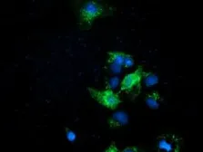 Anti-Ephrin A2 antibody [2B7] used in Immunocytochemistry/ Immunofluorescence (ICC/IF). GTX84588
