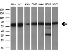 Anti-DYNC1LI1 antibody [1B9] used in Western Blot (WB). GTX84596