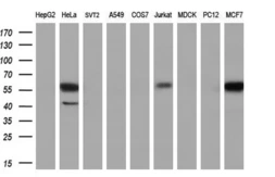 Anti-DYNC1LI1 antibody [1D1] used in Western Blot (WB). GTX84597