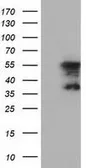Anti-DYNC1LI1 antibody [2B6] used in Western Blot (WB). GTX84599