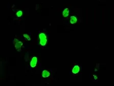 Anti-DNTTIP1 antibody [1E2] used in Immunocytochemistry/ Immunofluorescence (ICC/IF). GTX84603